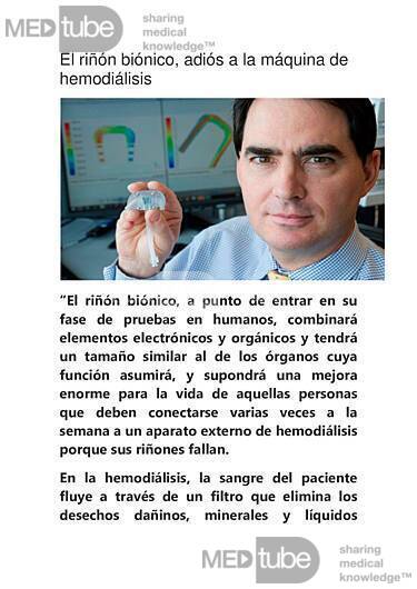 El riñón biónico