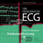 150 Problemas de ECG