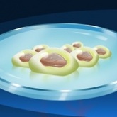 Moving Forward with Stem Cell Therapy