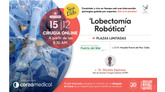 Lobectomía Robótica