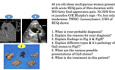 Patologías hepatobiliares-pancreáticas - preguntas basadas en imágenes