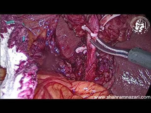 CHIRURGIE