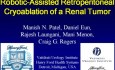 Crioablación renal retroperitoneal asistida por robot