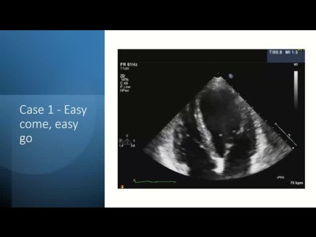 Evaluación ecocardiográfica de masas cardíacas: un enfoque sistemático mediante el aprendizaje basado en casos