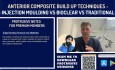 ¿Por qué el composite moldeado por inyección es superior a la estratificación?