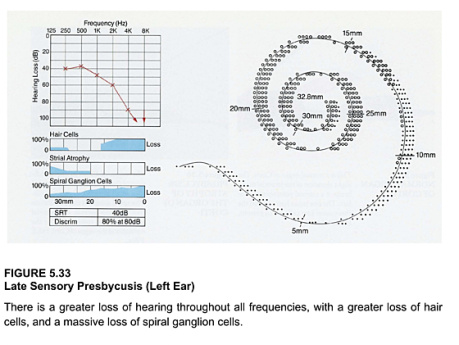 Enfermedades del oído Volumen 5 El oído interno