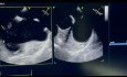 15. Caso de ecocardiografía - ¿Qué se ve?