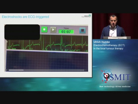 Electroquimioterapia (TEC) en la terapia focal del tumor - SMIT 2019