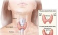 Técnica quirúrgica de tiroidectomía total (11 pasos para evitar complicaciones)
