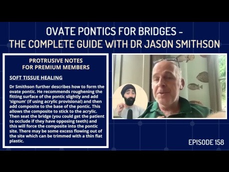 Pónticos ovados para puentes: la guía completa con el Dr. Jason Smithson