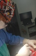 Craniectomía descompresiva en infarto maligno de la arteria cerebral media