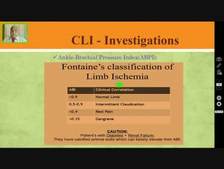 Isquemia crónica de miembros inferiores - enfermedades de arterias periféricas