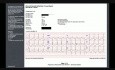 Caso de ECG 1