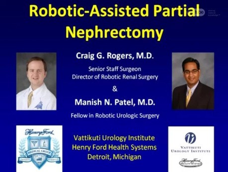 Nefrectomía parcial asistida por robot - Paso 5: Identificación del tumor
