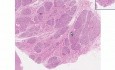Hiperplasia del tejido mamario durante el embarazo - histopatología mamaria