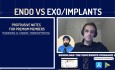 Endodoncia vs. Implantes con Omar Ikram