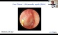 Actualización en otitis
