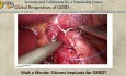 Espere un minuto: ¿Implantes de silicona para la ERGE?