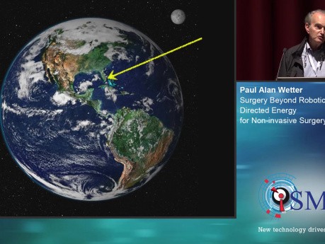 Cirugía más allá de la robótica: energía dirigida para cirugía no invasiva - SMIT 2019