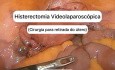 Histerectomía total laparoscópica [video corto]