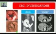 Cáncer de colon - hemorragia digestiva baja