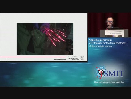 Terapia fotodinámica vascular focalizada (VTP) para el tratamiento focal del cáncer de próstata - SMIT 2019