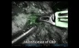 Resección robótica de la cabeza pancreática con neurectomía esplácnica guiada por fluorescencia para la preservación del conducto biliar en pancreatitis crónica