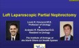 Nefrectomía parcial laparoscópica izquierda - Parte 1