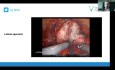 Abordaje posterolateral RARP