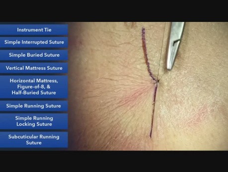 Hacer un nudo con instrumentos - técnicas de sutura