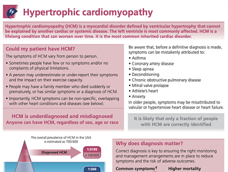  Miocardiopatía Hipertrófica 