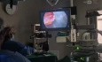 Herniolap tapp mas colelap en un solo acto quirurgico