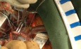 Cirugía cardíaca mínimamente invasiva (MICS), reparación de válvula mitral - técnica de canulación directa