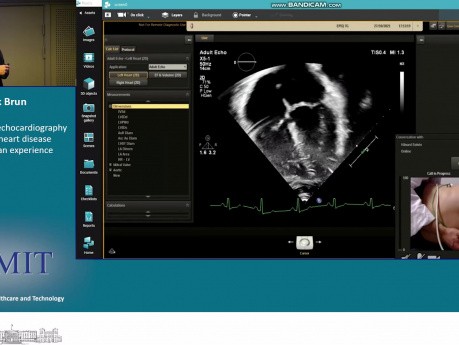 Ecocardiografía Asistida a Distancia en Cardiopatías Congénitas