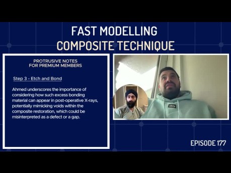 Técnica de modelado rápido de materiales compuestos: detalles completos