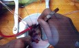 Toracotomía anterolateral derecha para AVR y MVrep