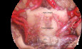 Diapositiva de anatomía