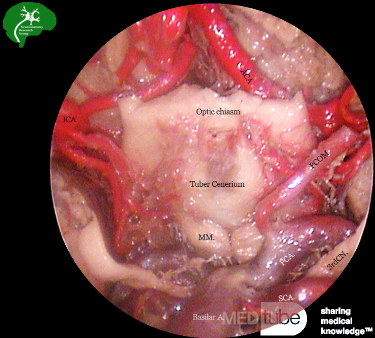 Diapositiva de anatomía