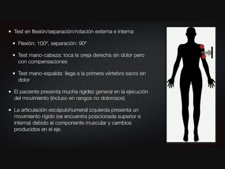 Dolor y otros desórdenes de la sensibilidad - Casos clínicos