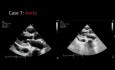 Fact or Artifact: A Case-Based Discussion