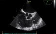 Ecocardiografía Transesofágica, Observación de la Válvula Pulmonar