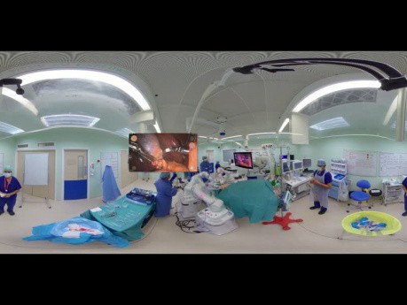 Colecistectomía con Versius en 360° en el Manchester University NHS FT