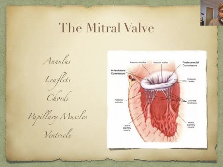 Respetar la válvula mitral