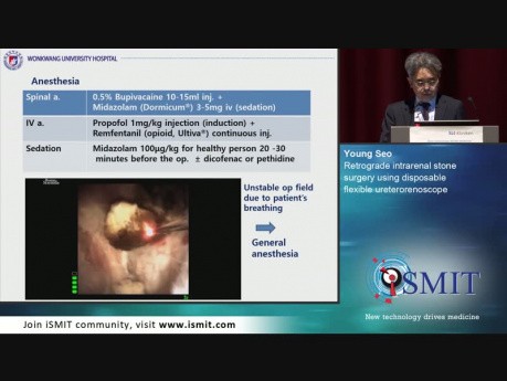 Cirugía retrógrada de cálculos intrarrenales con ureterorrenoscopio flexible desechable - SMIT 2019