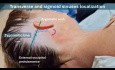 Localización de los senos transversos y sigmoideos