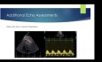 Achy Breaky Heart - ABCs of Takotsubo Cardiomyopathy