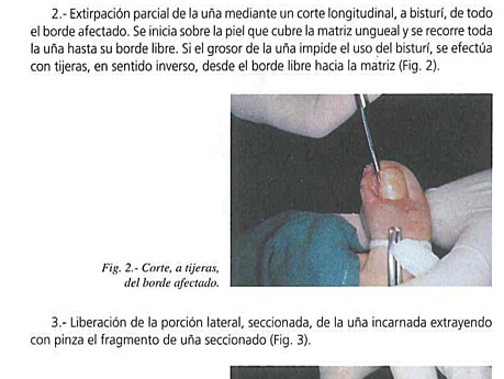 Manual de Cirugía Menor SSMS