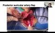 Abordaje Combinado Sistemático (Endoscopico y Microscopico) para Manejo de Colesteatomas