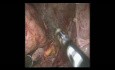 Feocromocitoma suprarrenal derecho