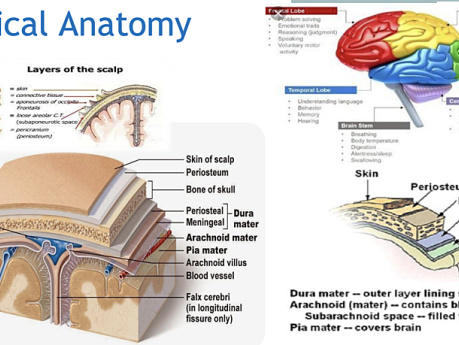 Trauma craneal